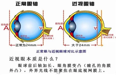 年轻无码视频网友认为这种内容虽然吸引眼球但也容易导致不良影响，呼吁加强对青少年的网络保护和引导