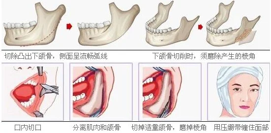 电爪术究竟有何魅力？深入解析电爪术的独特之处